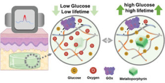 A Glucose Biosensor Based on Phosphorescence Lifetime Sensing and a Thermoresponsive Membrane