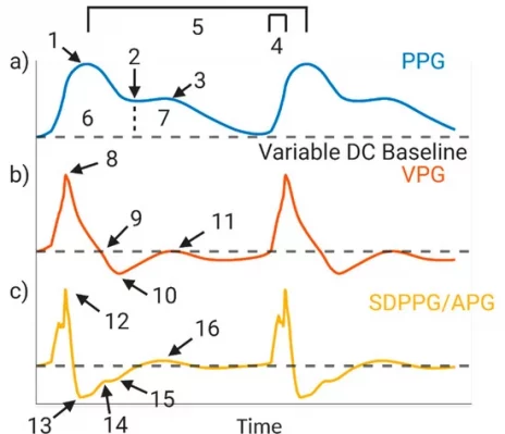 Figure 1
(a) Photoplethysmography (PPG) waveform: 1. systolic peak; 2. dicrotic notch; 3. diastolic peak; 4. slope transit time; 5. heart rate; 6. area under systolic waveform; 7. area under diastolic waveform; (b) first derivative, velocity plethysmograph (VPG): 8. max slope in systole; 9. end of systolic peak; 10. Start of dicrotic notch; 11. max slope in diastole; (c) second derivative, second derivative photoplethysmograph or acceleration plethysmograph (SDPPG/APG): 12. a-point; 13. b-point; 14. c-point; 15. d-point; 16. e-point.