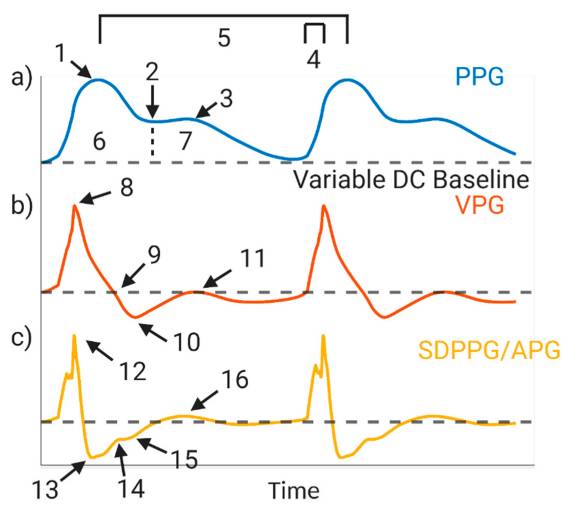 a) Photoplethysmography (PPG) waveform: 1. systolic peak; 2. dicrotic notch; 3. diastolic peak; 4. slope transit time; 5. heart rate; 6. area under systolic waveform; 7. area under diastolic waveform; (b) first derivative, velocity plethysmograph (VPG): 8. max slope in systole; 9. end of systolic peak; 10. Start of dicrotic notch; 11. max slope in diastole; (c) second derivative, second derivative photoplethysmograph or acceleration plethysmograph (SDPPG/APG): 12. a-point; 13. b-point; 14. c-point; 15. d-point; 16. e-point. Created with BioRender.com.